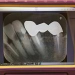 携帯形X線撮影装置